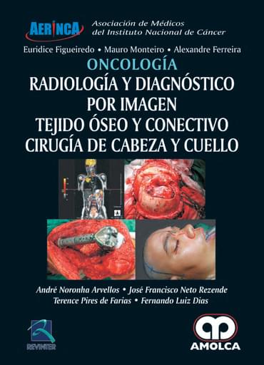 Oncología. Radiología y Diagnóstico por Imagen.Tejido Óseo y Conectivo