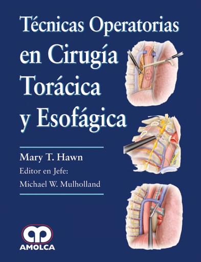 Técnicas operatorias en cirugía toracica y esofágica