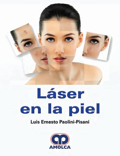 Láser en la piel