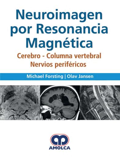 Neuroimagen por resonancia magnética. Cerebro, columna vertebral, nervios periféricos