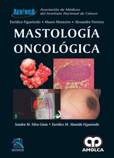 Mastología oncológica