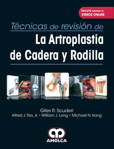 Técnicas de revisión de la artroplastia de cadera y rodilla