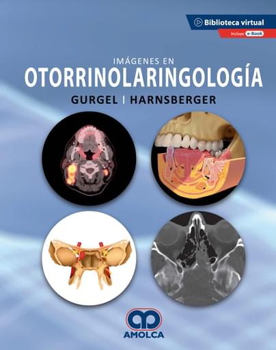 Imagenes en Otorrinolaringologia