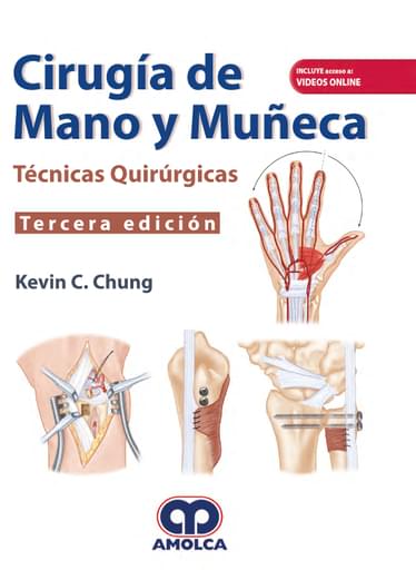 Cirugía de mano y muñeca. Técnicas Quirúrgicas 3 edición