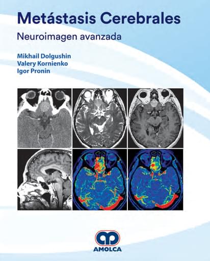 Metástasis Cerebrales Neuroimagen Avanzada