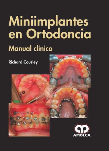 Miniimplantes en Ortodoncia Manual Clínico