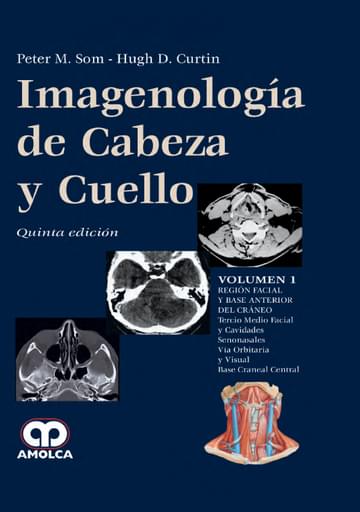 Imagenología de Cabeza y Cuello