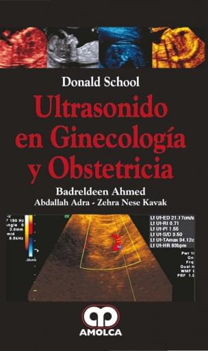 Ultrasonido en Ginecología y Obstetricia