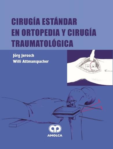 Cirugía Estándar en Ortopedia y Cirugía Traumatológica