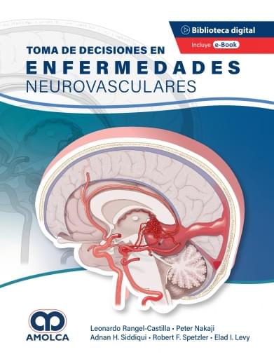 Toma de Decisiones en enfermedades neurovasculares