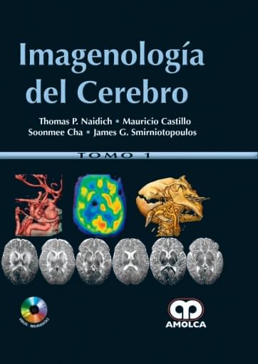 Imagenología del Cerebro 2 Tomos