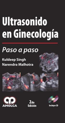 Ultrasonido en Ginecología, Paso a Paso