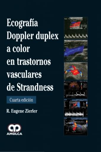 Ecografía Doppler Duplex a Color en Trastornos Vasculares de Strandness. 4 edición