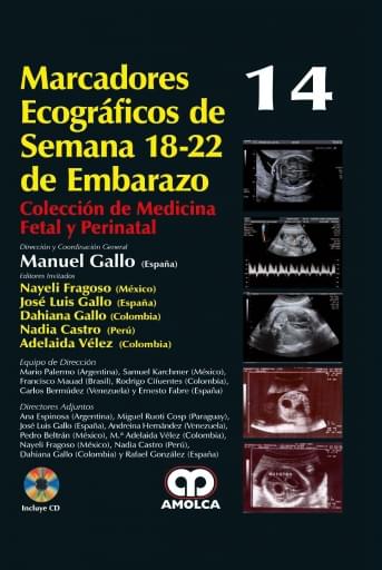 Marcadores Ecográficos de Semana 18-22 de Embarazo (14)