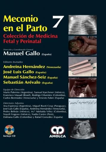 Meconio en el Parto (7)