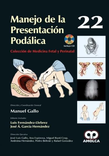 Manejo de la Presentación Podálica (22)