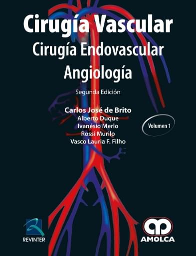 Cirugía Vascular. Cirugía Endovascular Angiología 2 edición