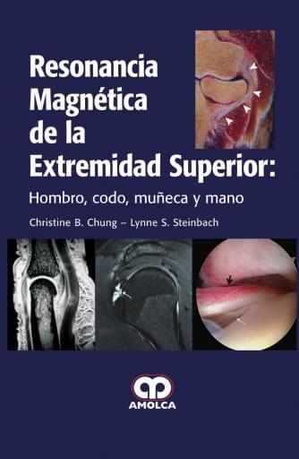 Resonancia Magnética de la Extremidad Superior: Hombro, codo, muñeca y mano