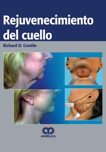 Rejuvenecimiento del Cuello