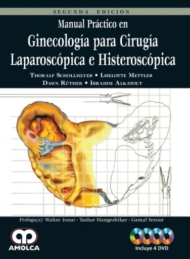Manual Práctico en Ginecología para Cirugía Laparoscópica e Histeroscópica Segunda edición
