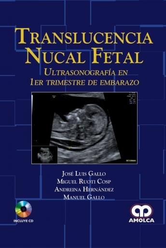 Translucencia Nucal Fetal Ultrasonografías en 1er trimestre de embarazo