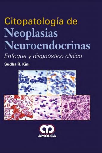 CITOPATOLOGÍA DE NEOPLASIAS NEUROENDOCRINAS Enfoque y diagnóstico clínico