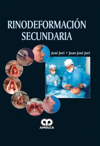 Rinodeformación Secundaria