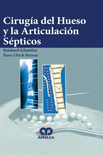 Cirugía del Hueso y la Articulación Sépticos