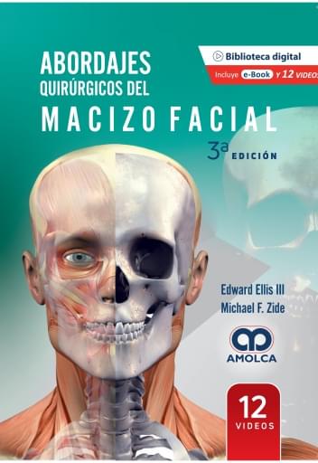 Abordajes quirúrgicos del macizo facial 3.ª edición