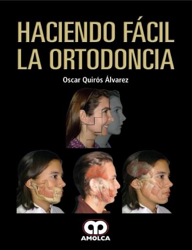 Haciendo Fácil la Ortodoncia