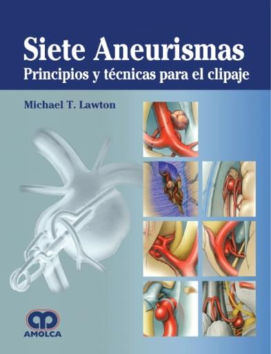 Siete Aneurismas - Principios y técnicas para el clipaje