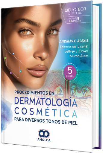 Procedimientos en dermatología cosmética para diversos tonos de piel, 1e