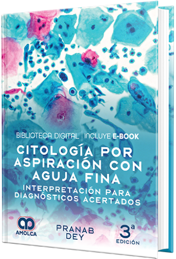 Citología por aspiración con aguja fina. Interpretación para diagnósticos acertados