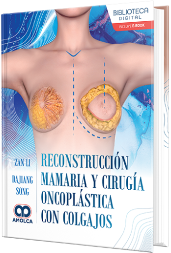 Reconstrucción mamaria y cirugía oncoplástica con colgajos