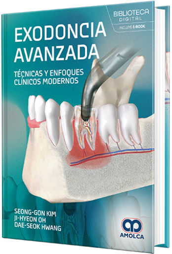 Exodoncia avanzada. Técnicas y enfoques clínicos modernos