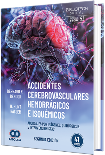 Accidentes cerebrovasculares hemorrágicos e isquémicos. Abordajes por imágenes, quirúrgicos e intervencionistas
