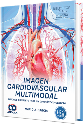 Imagen cardiovascular multimodal. Enfoque completo para un diagnóstico certero