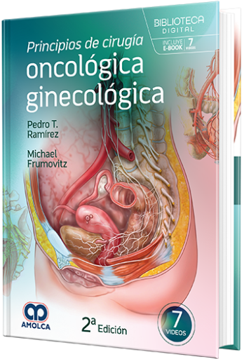 Principios de cirugía oncológica ginecológica