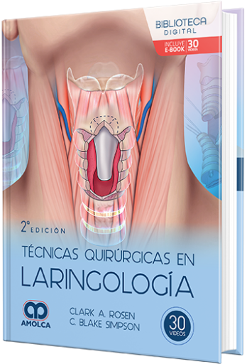 Técnicas quirúrgicas en laringología