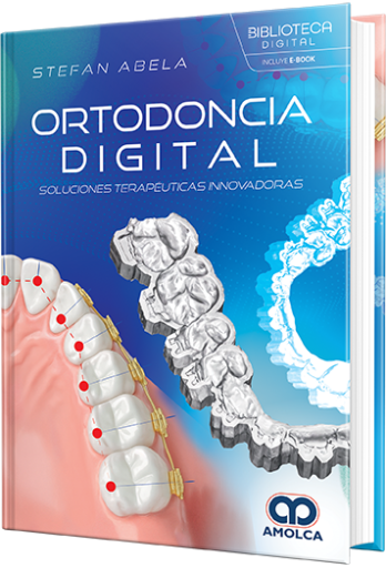 Ortodoncia digital. Soluciones terapéuticas innovadoras
