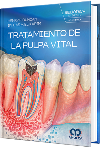 Tratamiento de la pulpa vital