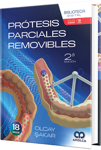 Prótesis parciales removibles