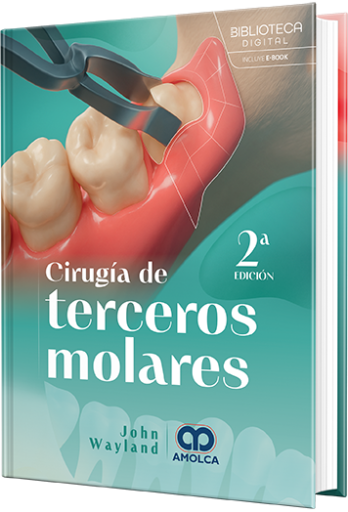 Cirugía de terceros molares