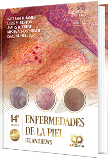Enfermedades de la piel de Andrews