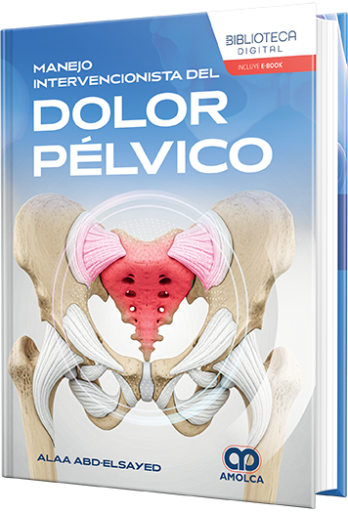 Manejo intervencionista del dolor pélvico