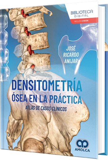 Densitometría ósea en la práctica. Atlas de casos clínicos