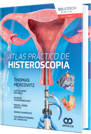 Atlas práctico de histeroscopia