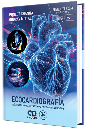 Ecocardiografía. Guía práctica para intensivistas y médicos de urgencias