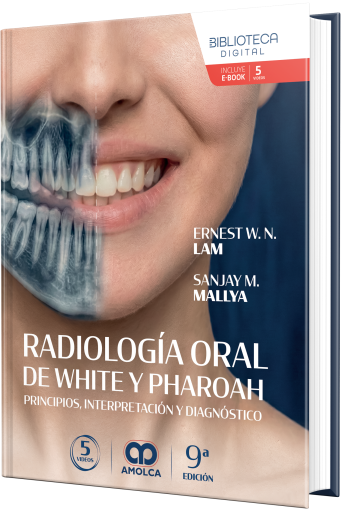 Radiología oral de White y Pharoah. Principios, interpretación y diagnóstico