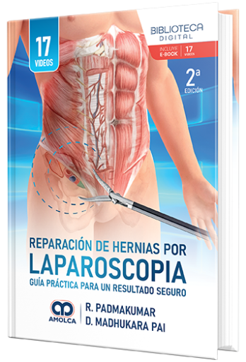 Reparación de hernias por laparoscopia. Guía práctica para un resultado seguro
